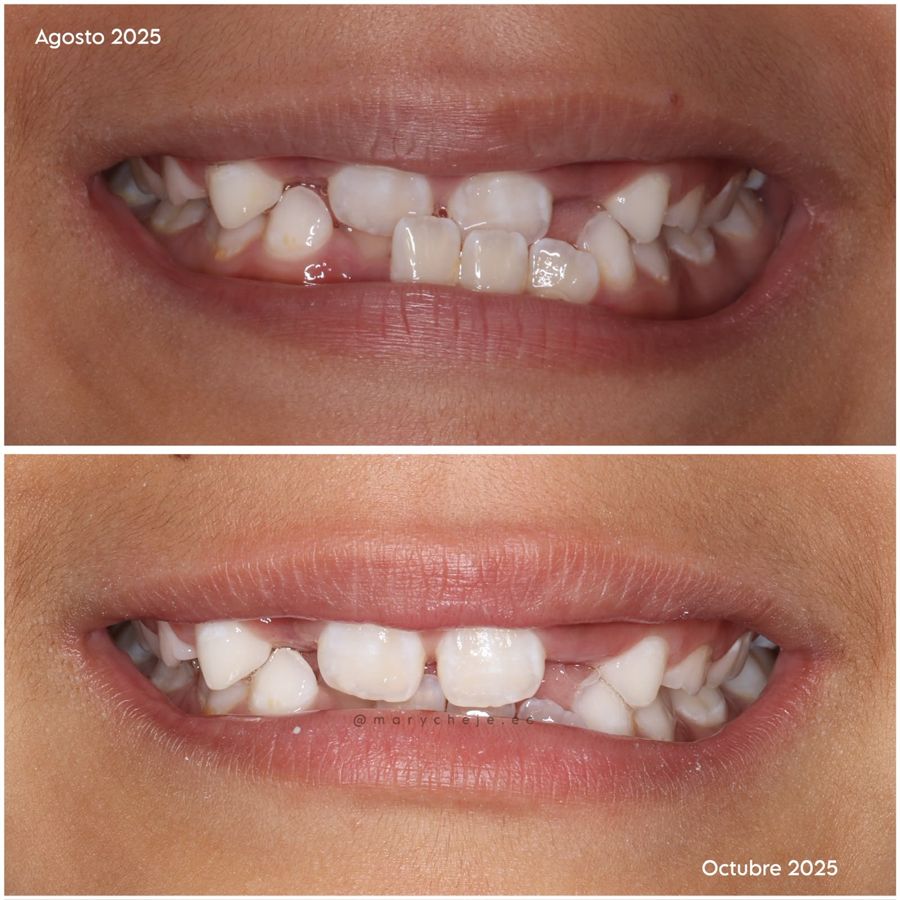 Sonrisa en agosto y en octubre de 2025
